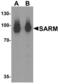 Sterile alpha and TIR motif-containing protein 1 antibody, LS-C153716, Lifespan Biosciences, Western Blot image 