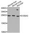 S100 Calcium Binding Protein A3 antibody, A4102, ABclonal Technology, Western Blot image 