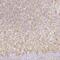 Solute Carrier Family 18 Member A1 antibody, NBP2-55798, Novus Biologicals, Immunohistochemistry paraffin image 