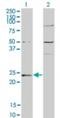 Guanylate kinase antibody, NBP2-23758, Novus Biologicals, Western Blot image 