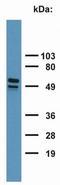 Keratin 17 antibody, NB500-352, Novus Biologicals, Western Blot image 