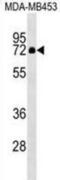 Zinc Finger Protein 57 antibody, abx029747, Abbexa, Western Blot image 