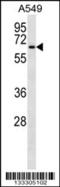 Transmembrane 9 Superfamily Member 1 antibody, 56-981, ProSci, Western Blot image 