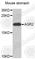 Anterior Gradient 2, Protein Disulphide Isomerase Family Member antibody, A2632, ABclonal Technology, Western Blot image 