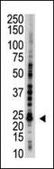 Ubiquitin Conjugating Enzyme E2 S antibody, PA5-11973, Invitrogen Antibodies, Western Blot image 