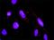 Mitogen-Activated Protein Kinase Kinase 6 antibody, H00005608-M02, Novus Biologicals, Proximity Ligation Assay image 