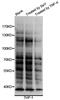 Phosphotyrosine antibody, STJ113508, St John