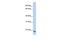 Transmembrane Protein 35A antibody, GTX46026, GeneTex, Western Blot image 