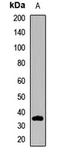 ELMO Domain Containing 2 antibody, LS-C668959, Lifespan Biosciences, Western Blot image 