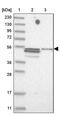 Tripartite Motif Containing 11 antibody, PA5-55893, Invitrogen Antibodies, Western Blot image 