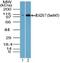 RAD17 Checkpoint Clamp Loader Component antibody, NBP2-24457, Novus Biologicals, Western Blot image 