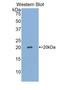 Sialic Acid Binding Ig Like Lectin 14 antibody, LS-C296409, Lifespan Biosciences, Western Blot image 