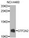 General Transcription Factor IIA Subunit 2 antibody, A13029, Boster Biological Technology, Western Blot image 