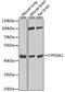 Cytochrome P450 Family 20 Subfamily A Member 1 antibody, 22-254, ProSci, Western Blot image 