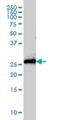 Syntaxin 8 antibody, H00009482-M01, Novus Biologicals, Western Blot image 