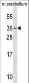 Mesoderm Posterior BHLH Transcription Factor 1 antibody, LS-C164484, Lifespan Biosciences, Western Blot image 