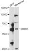 CAMP Responsive Element Binding Protein 5 antibody, LS-C749630, Lifespan Biosciences, Western Blot image 