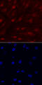 Interleukin 33 antibody, MAB3626, R&D Systems, Immunocytochemistry image 