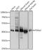 Pyruvate Dehydrogenase E1 Alpha 2 Subunit antibody, LS-C749971, Lifespan Biosciences, Western Blot image 