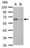 TGF-Beta Activated Kinase 1 (MAP3K7) Binding Protein 1 antibody, PA5-28600, Invitrogen Antibodies, Western Blot image 