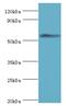 T-complex protein 1 subunit gamma antibody, MBS1498427, MyBioSource, Western Blot image 