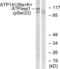 ATPase Na+/K+ Transporting Subunit Alpha 1 antibody, LS-C198651, Lifespan Biosciences, Western Blot image 