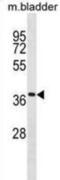 Transmembrane Protein 158 (Gene/Pseudogene) antibody, abx030986, Abbexa, Western Blot image 