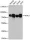 RIO Kinase 2 antibody, A09743, Boster Biological Technology, Western Blot image 