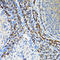 Signal Recognition Particle 19 antibody, LS-C334921, Lifespan Biosciences, Immunohistochemistry frozen image 