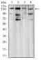 1-phosphatidylinositol-4,5-bisphosphate phosphodiesterase gamma-1 antibody, NBP2-52533, Novus Biologicals, Western Blot image 