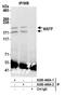 Bromodomain Adjacent To Zinc Finger Domain 1B antibody, A300-446A, Bethyl Labs, Immunoprecipitation image 