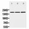 Early Growth Response 2 antibody, orb137949, Biorbyt, Western Blot image 