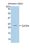 Protein S antibody, LS-B15000, Lifespan Biosciences, Western Blot image 