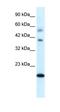 NADH:Ubiquinone Oxidoreductase Complex Assembly Factor 2 antibody, orb75293, Biorbyt, Western Blot image 