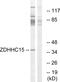 Zinc Finger DHHC-Type Containing 15 antibody, GTX87194, GeneTex, Western Blot image 