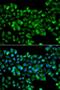 Carbonyl Reductase 3 antibody, LS-C349230, Lifespan Biosciences, Immunofluorescence image 