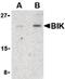 Bcl-2-interacting killer antibody, orb86689, Biorbyt, Western Blot image 