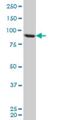 Threonyl-tRNA synthetase, cytoplasmic antibody, H00006897-M01, Novus Biologicals, Western Blot image 