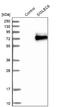 Sialic Acid Binding Ig Like Lectin 6 antibody, NBP1-85757, Novus Biologicals, Western Blot image 