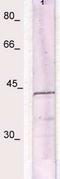NFKB Inhibitor Alpha antibody, TA354676, Origene, Western Blot image 