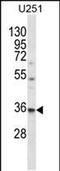 VPS37B Subunit Of ESCRT-I antibody, PA5-48373, Invitrogen Antibodies, Western Blot image 