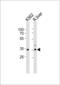 ATPase Na+/K+ Transporting Subunit Beta 2 antibody, GTX80450, GeneTex, Western Blot image 