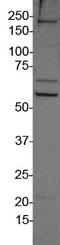 DNA Methyltransferase 1 antibody, NB100-264, Novus Biologicals, Western Blot image 