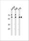 Acetylcholinesterase antibody, A03519-1, Boster Biological Technology, Western Blot image 