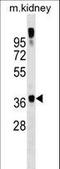 General Transcription Factor IIA Subunit 1 antibody, LS-C159797, Lifespan Biosciences, Western Blot image 