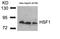 Heat Shock Transcription Factor 1 antibody, GTX50535, GeneTex, Western Blot image 