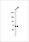 ADAM Metallopeptidase With Thrombospondin Type 1 Motif 4 antibody, GTX81446, GeneTex, Western Blot image 