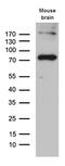 Long-chain-fatty-acid--CoA ligase 5 antibody, M05087, Boster Biological Technology, Western Blot image 