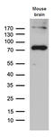 Acyl-CoA Synthetase Long Chain Family Member 5 antibody, M05087, Boster Biological Technology, Western Blot image 