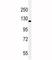 Ret Proto-Oncogene antibody, F53523-0.1ML, NSJ Bioreagents, Western Blot image 